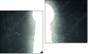 Diptychon